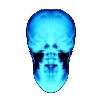 Skull, par Xavier E. G. Dierick